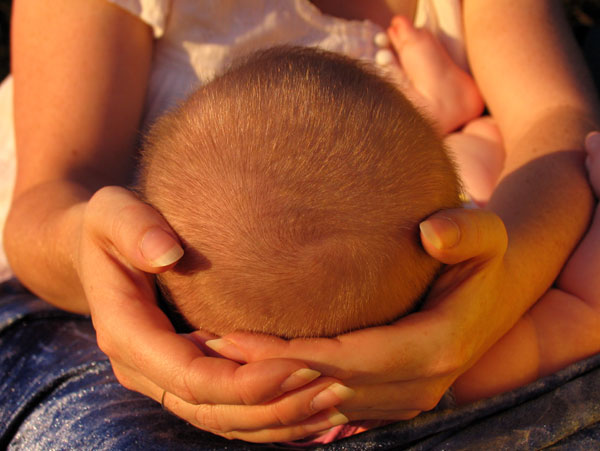 Maia's scalp, 4 months.